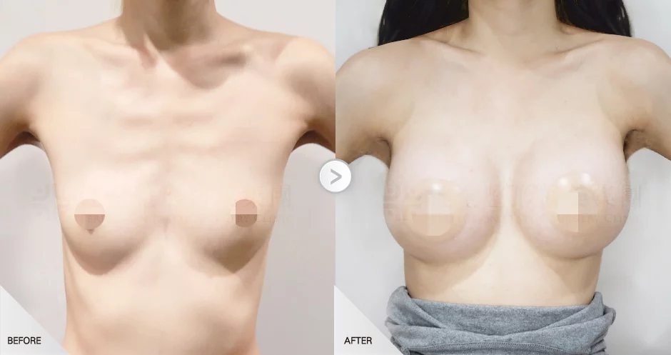 04f316f34a10454e8824e17c53240e44