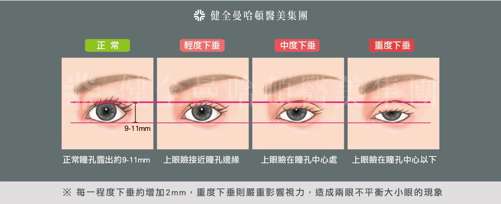 18d485bb3ad745f5b6a66342346d77c8 1