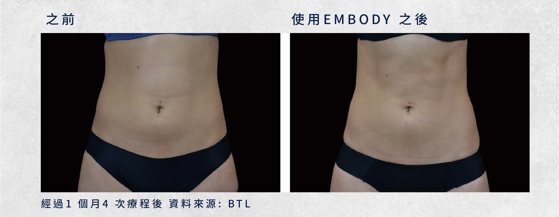 24bbc9cec1f14d56972a49f087435e30 1