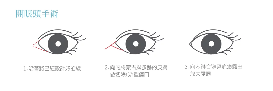 3b113d42ccac43528cfb780513dc100c 1