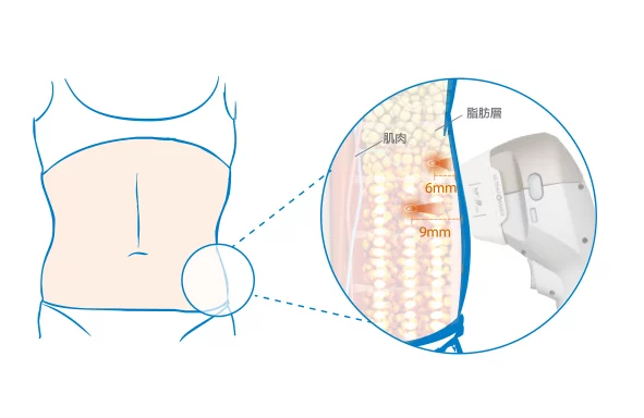 3d30960a85f64dc0bd04a1da57b384fe