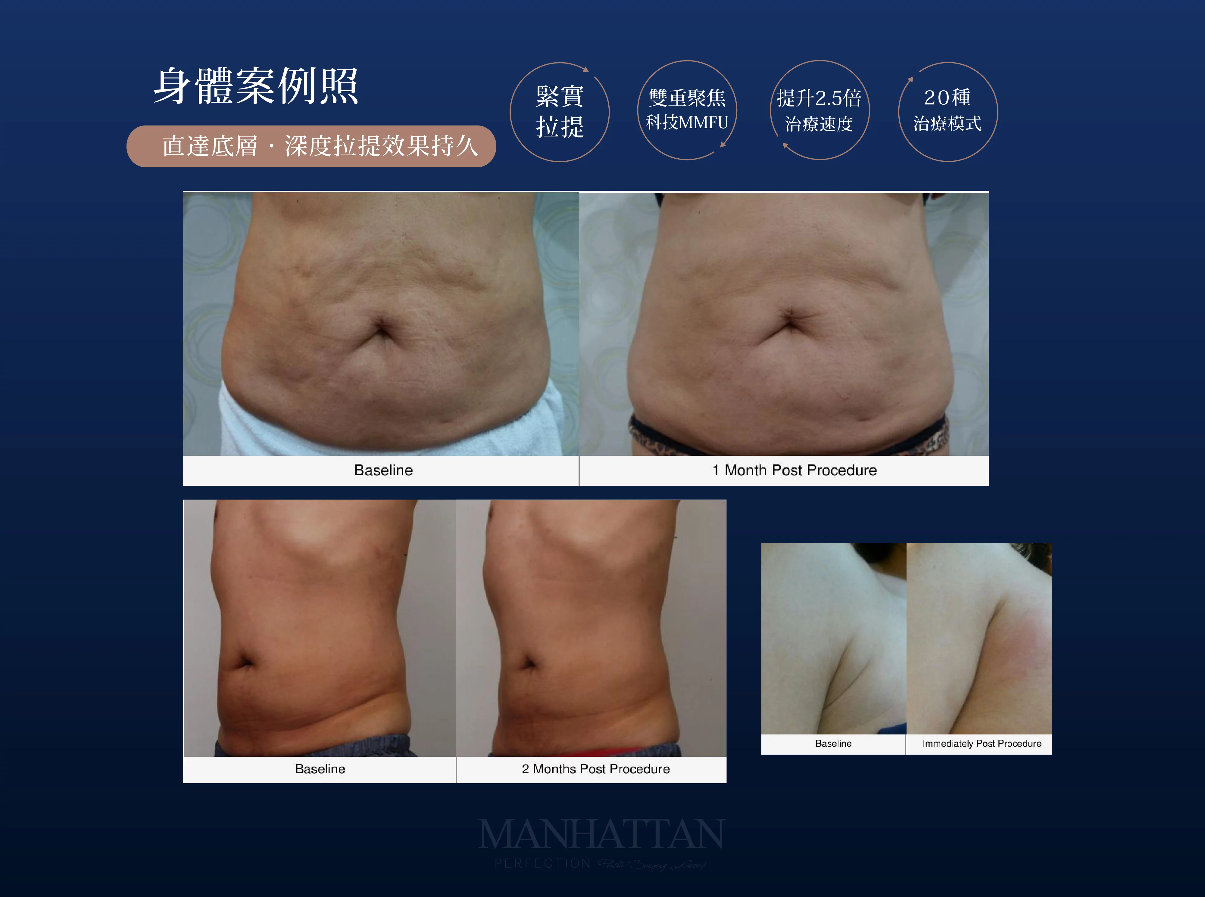 3db932c7f4a84e10b79f8e11c4856804