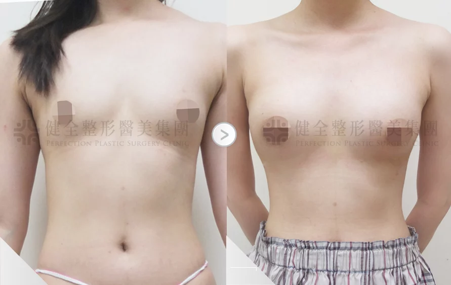 4177c1242cd14161bfa1ca2b0c326e9c