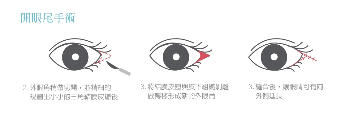 5c0ec0c2989147e1a2e632b0574bb73e 1