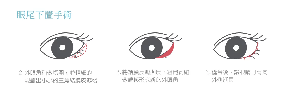 78d46cf172f04087af8f19db1ebf2c5e 1