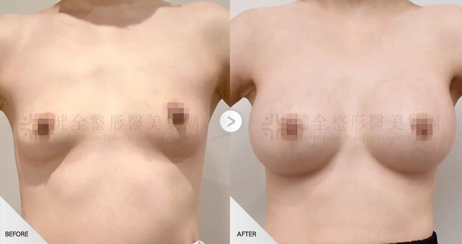 C3590a937cde4493a6b2bccedc0a513b