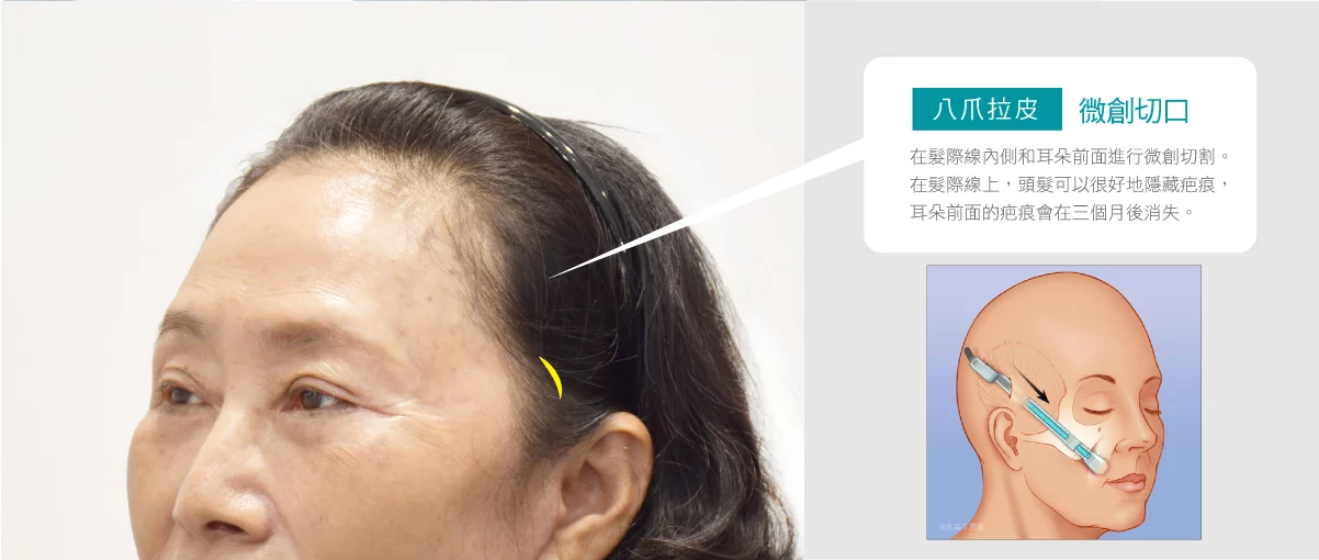 21ecfb06e51a4b24b33ed56a382a4516