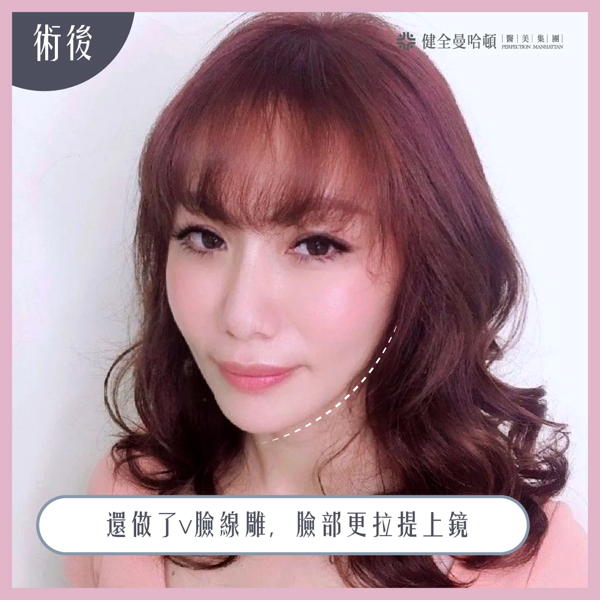 29ace4cd8024438f982bb26de6f7230a 1