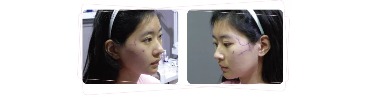 2ad656e727b44f889b10c29243e6c2b1