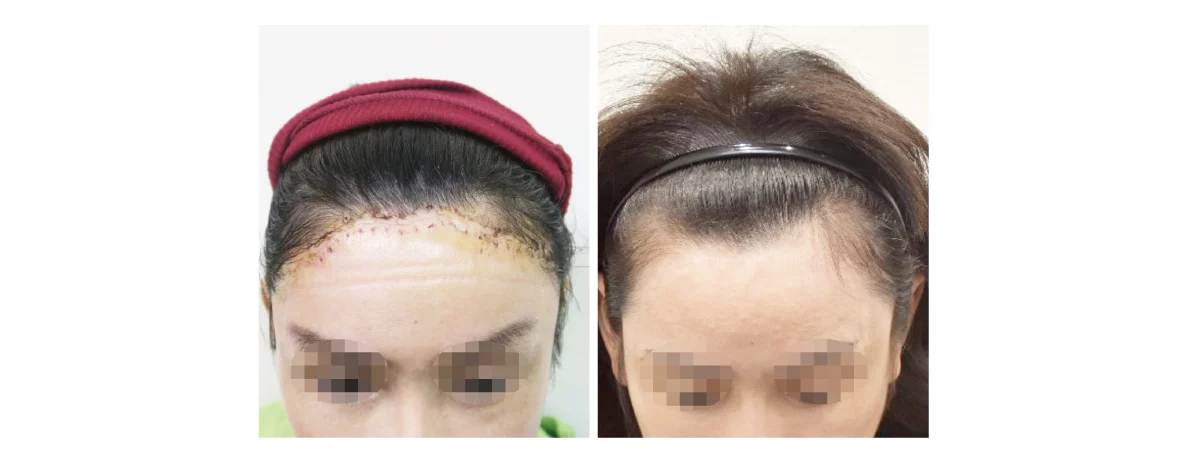 2b3497b02879440f8bfb130bf53a1495 1