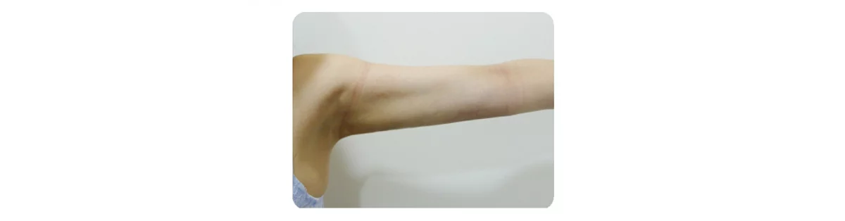 408b573dc6e845269a5f5041d195ed8c