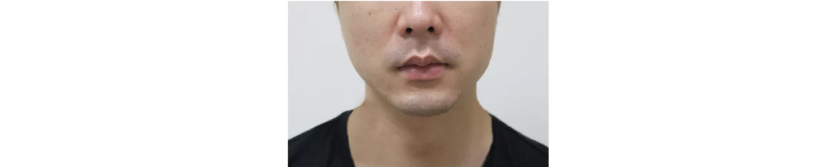 423079aef6644127bd0c48dc87aa3c78