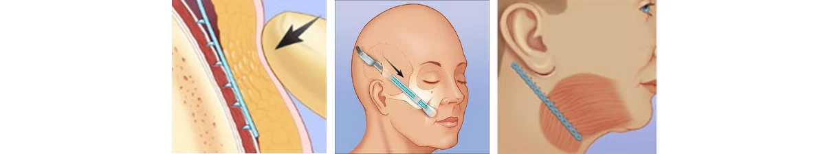 4789780d 95b8 46bc 9817 37f69a3bba0d