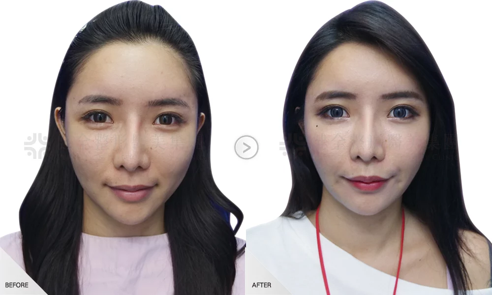 49bd894c5ca94a01b2b830f7ea5202e9