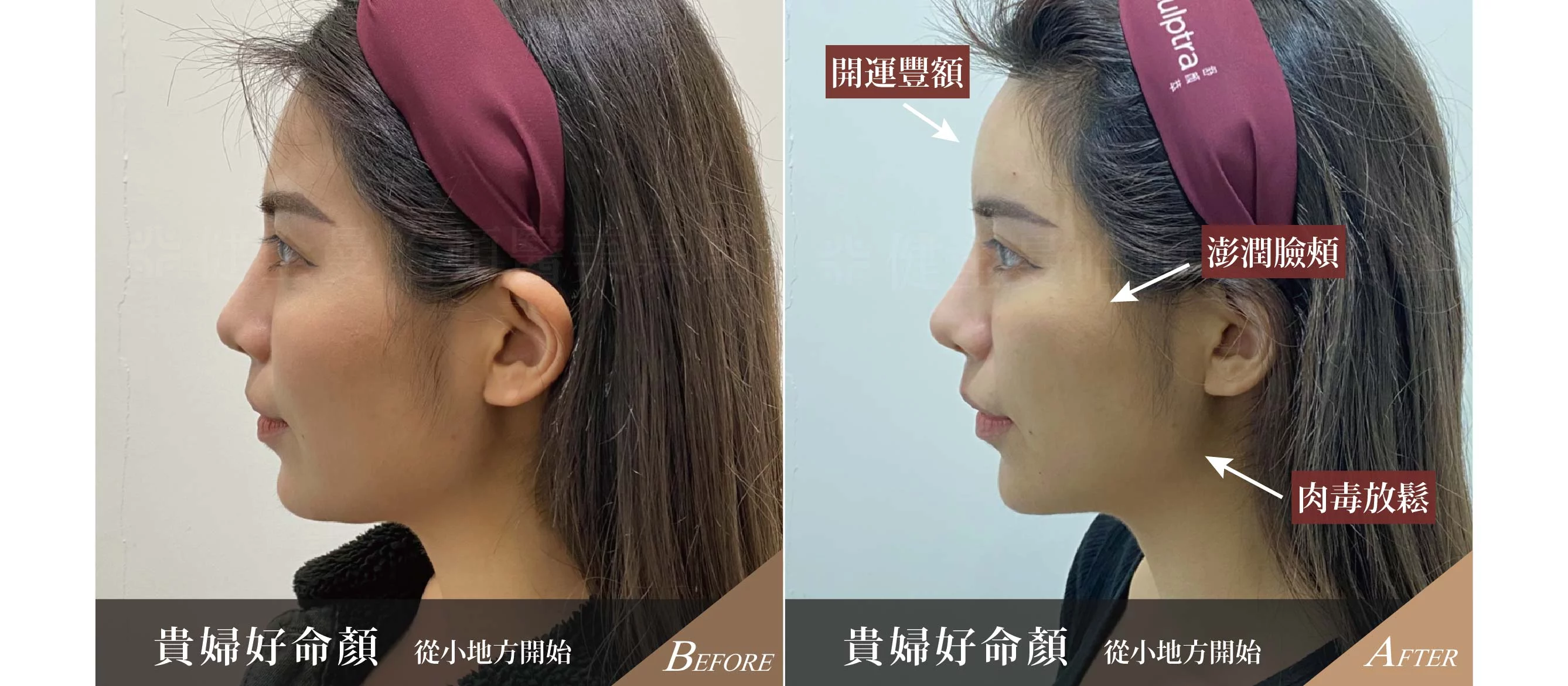 5d9be70910cf47b8a3d0405305e07082