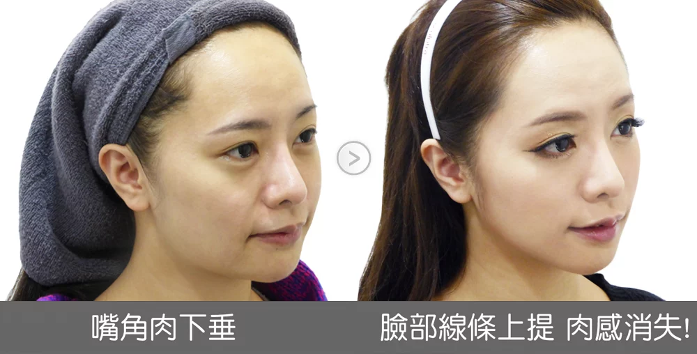 6950f115ee2841aaa0def8dcb9d2085a