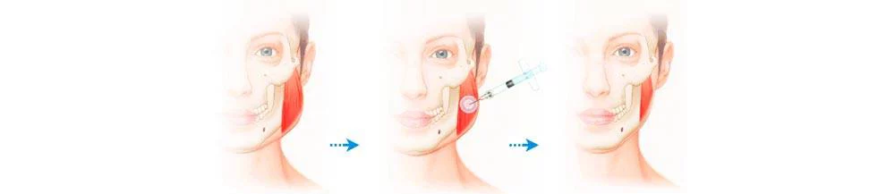 6b66f495 376a 4a2d Ad81 F2cd43896a0d