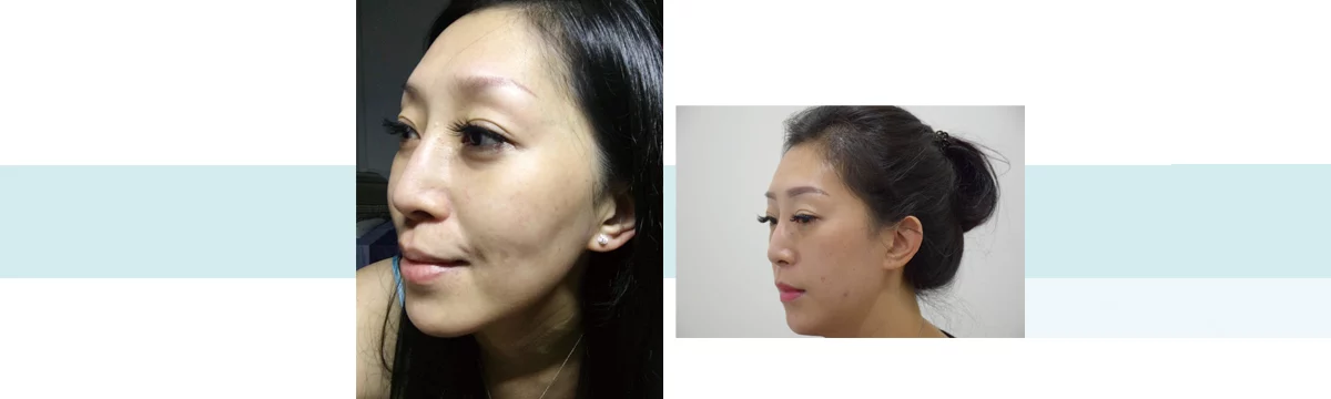 7e63d8805f3a485ba4bda29163c19862