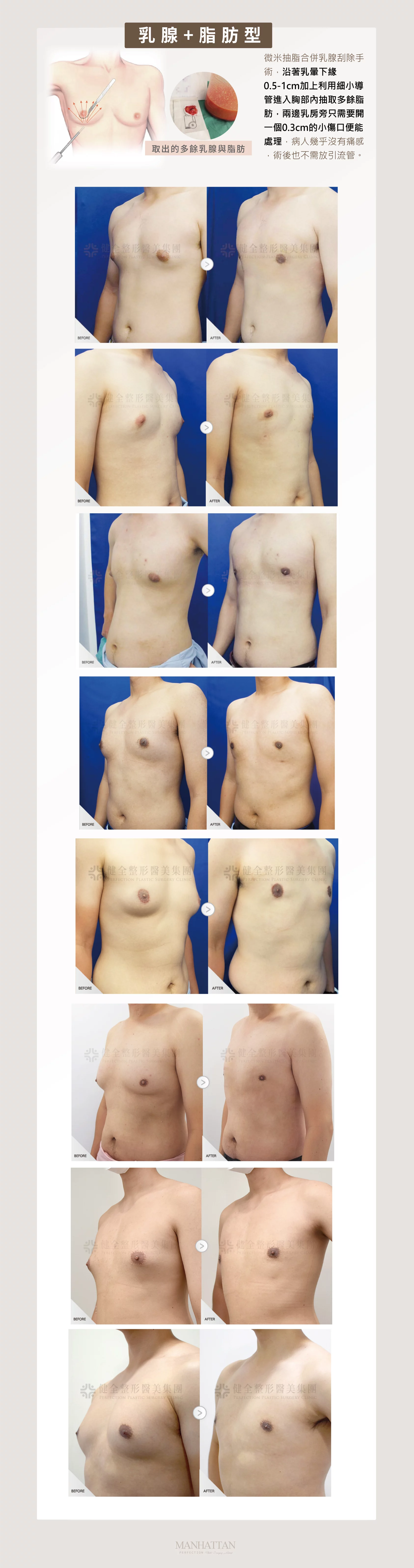 8f1b4866c20e4440bd8c93b4eef79928