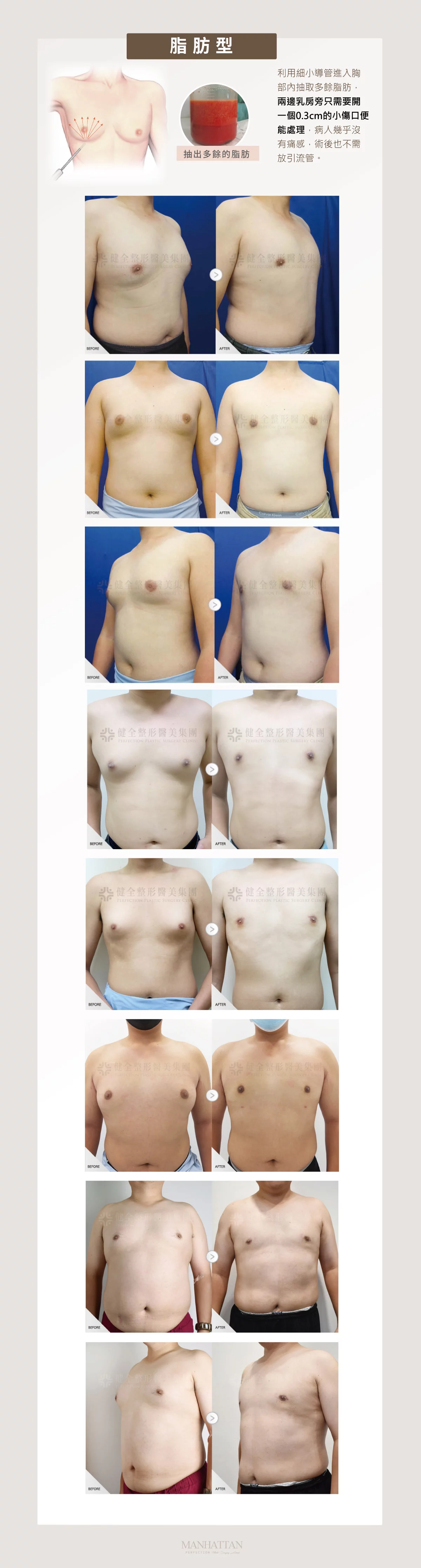 A959ba1c64914898a5be523e27573925