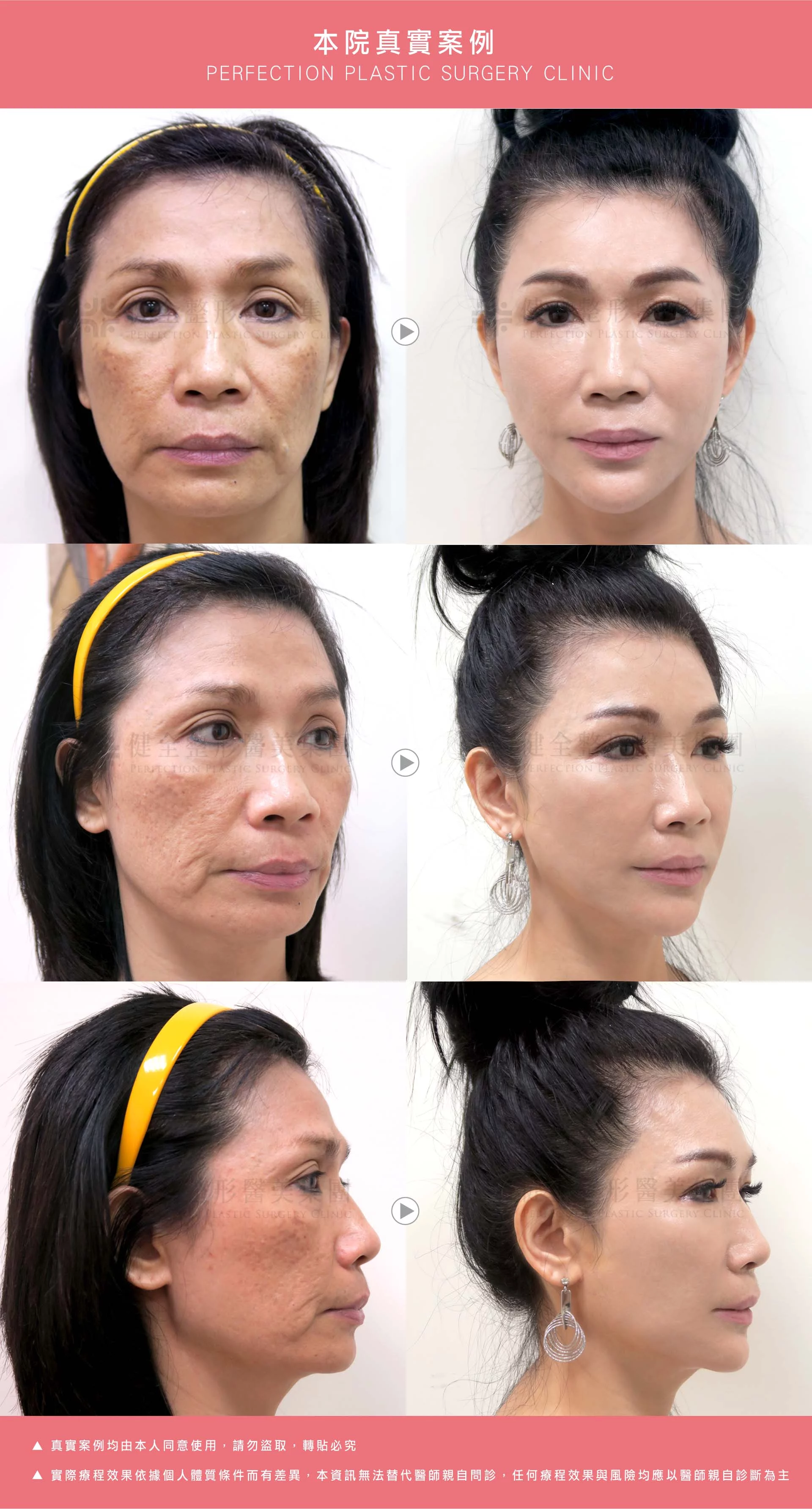 Bb0f3443c090444d9658fef22ec0dc40