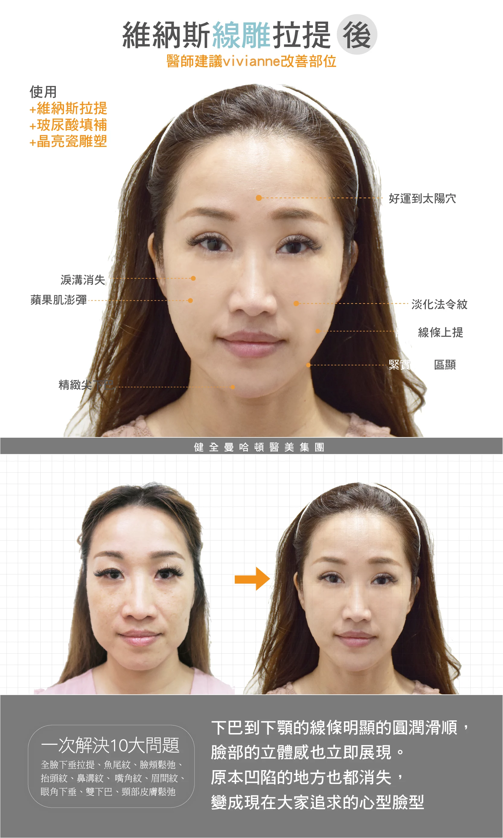 Cbec01a2bc3541688c5a70a5d8302c16 2