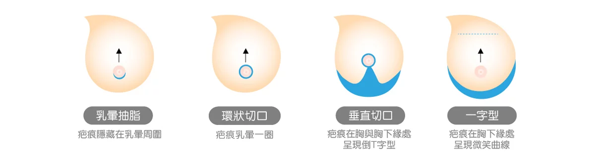 E955cfcacc8146b59c56ea5177c053e2 1