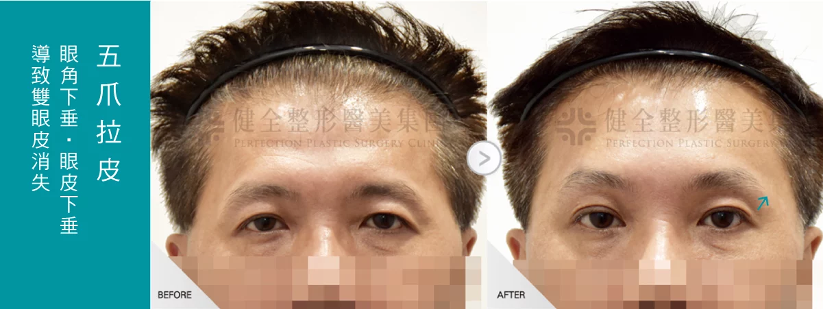 Fd160ddfd6dd4fc58573cfedc5eabc36