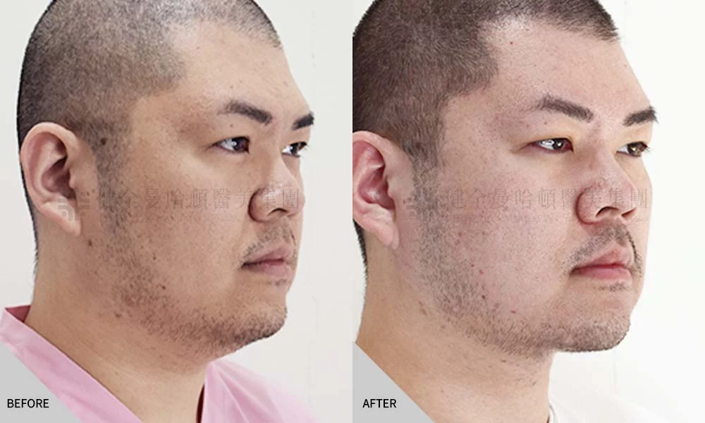 天鵝頸 傅偉傑 01