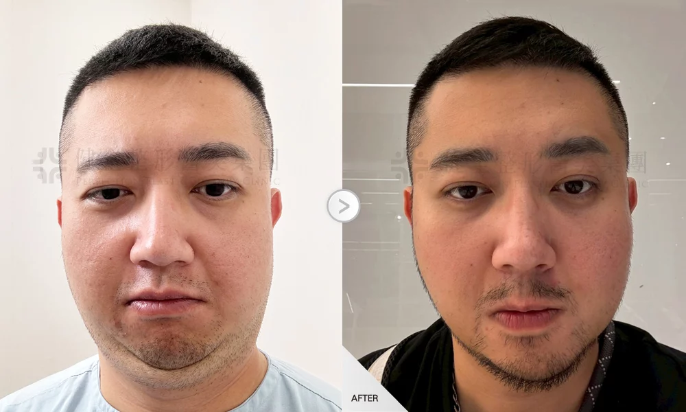 天鵝頸 陳彥伯 02