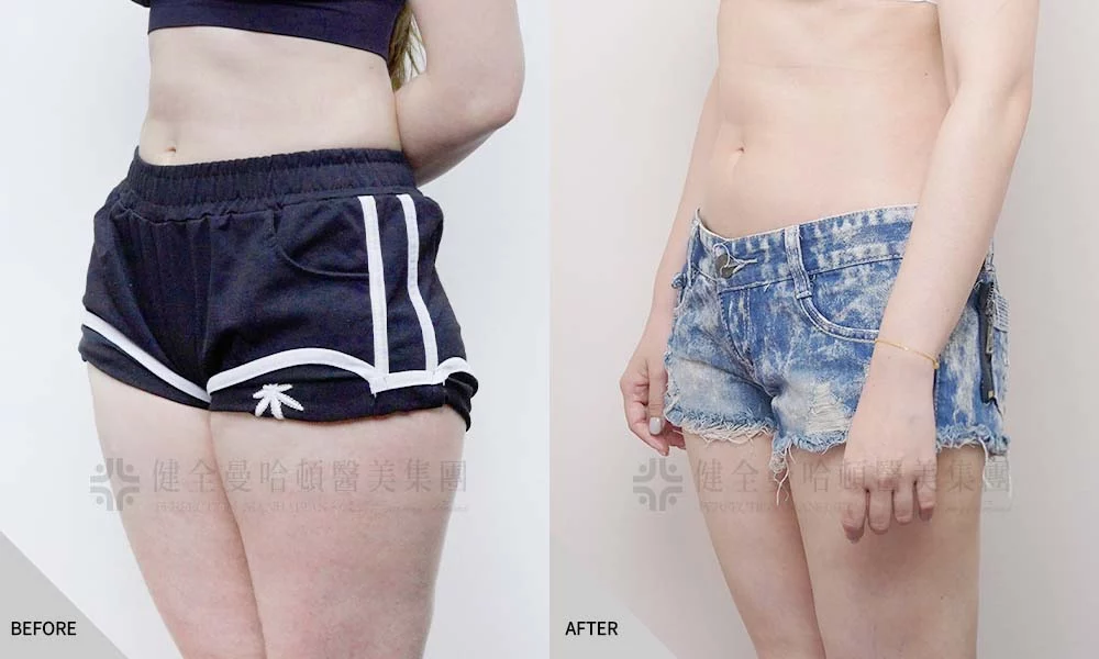 涂佩均 大腿環抽 02