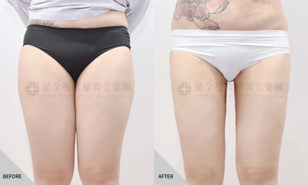 田欣樺 大腿環抽 01