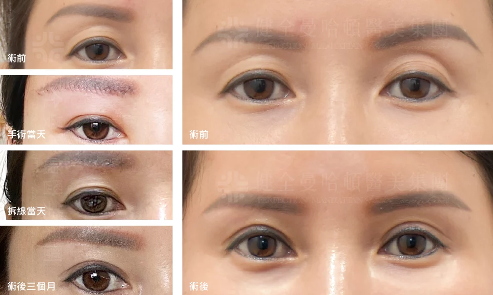 眉切 張素貞 拼貼