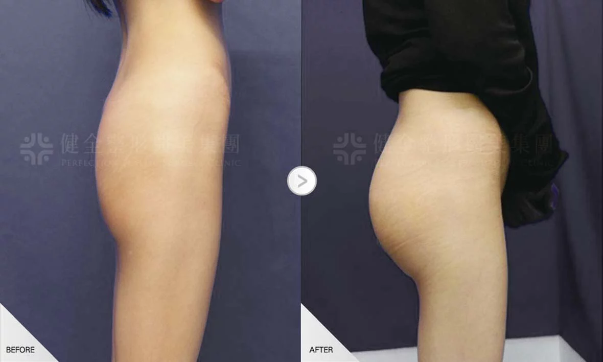 豐臀 02