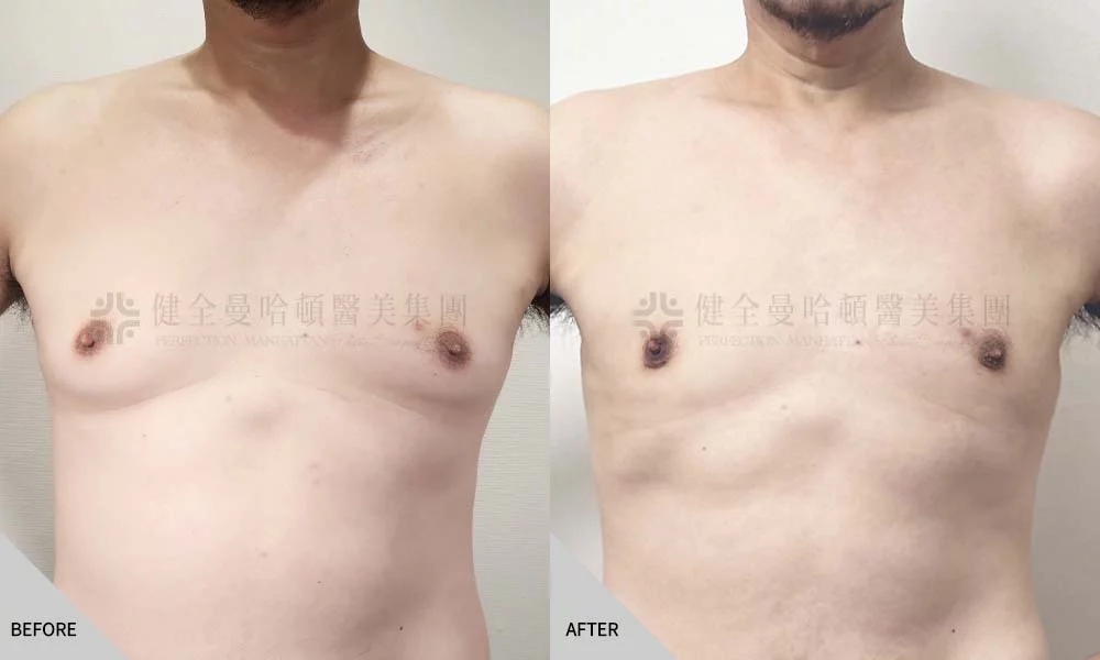 鄭世彬 男性女乳 01