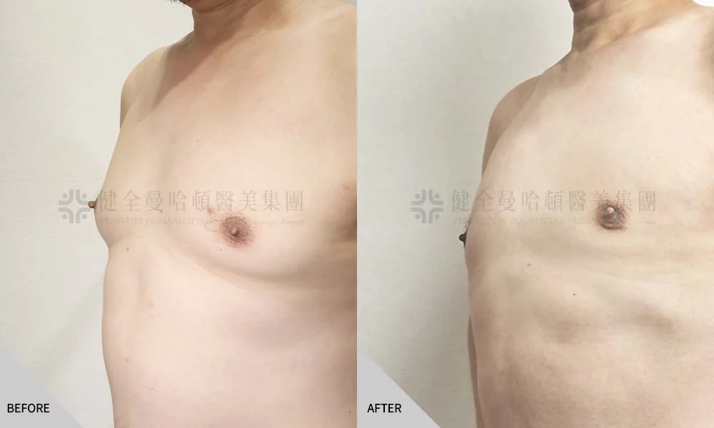 鄭世彬 男性女乳 02