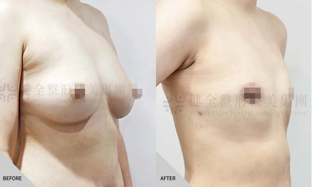 陳姄仁 平胸 02