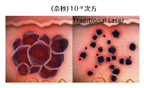 Pico皮秒雷射 奈秒