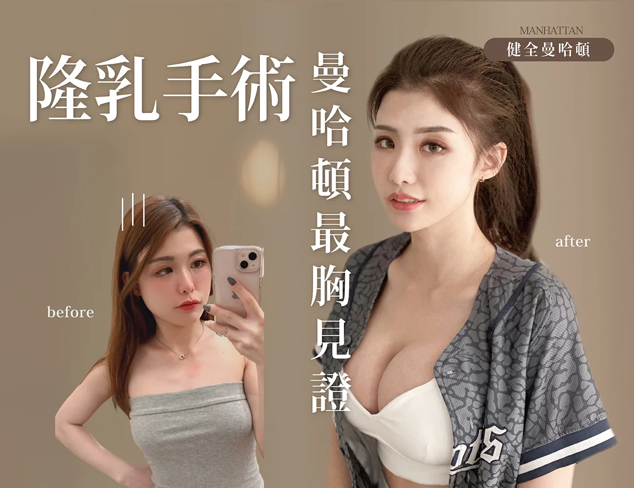 【隆乳】Una