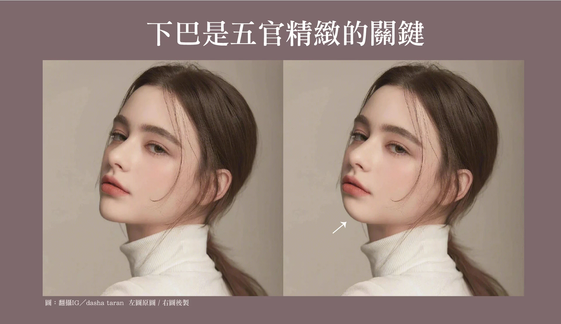 下巴精雕 下巴精緻