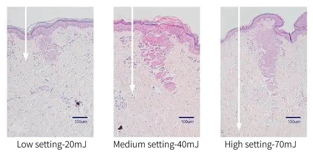 彩衝光梭 梭時雷射