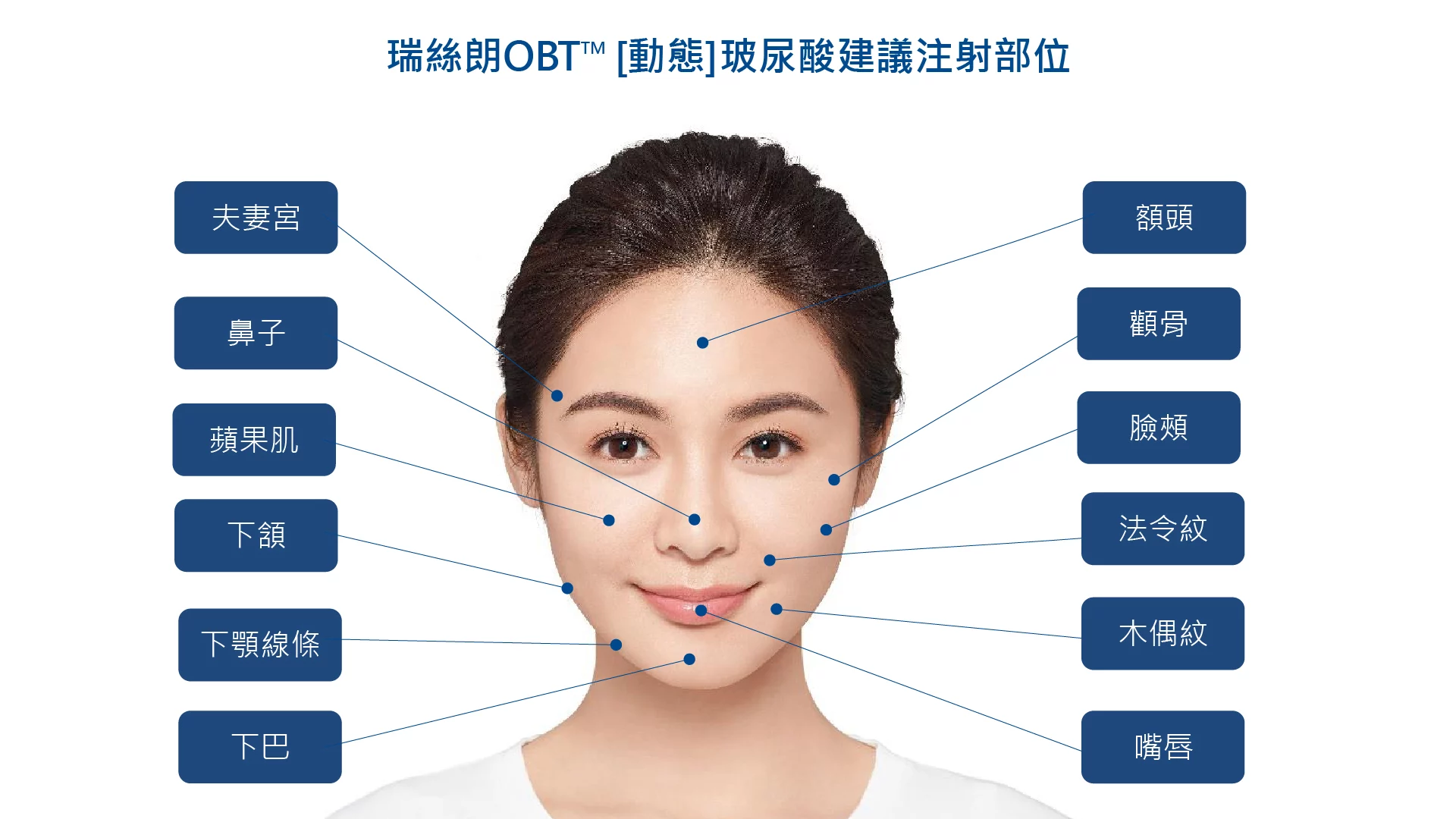 瑞斯朗玻尿酸 女神玻尿酸 施打部位