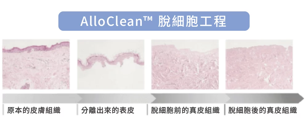 異體真皮粉 脫細胞 1