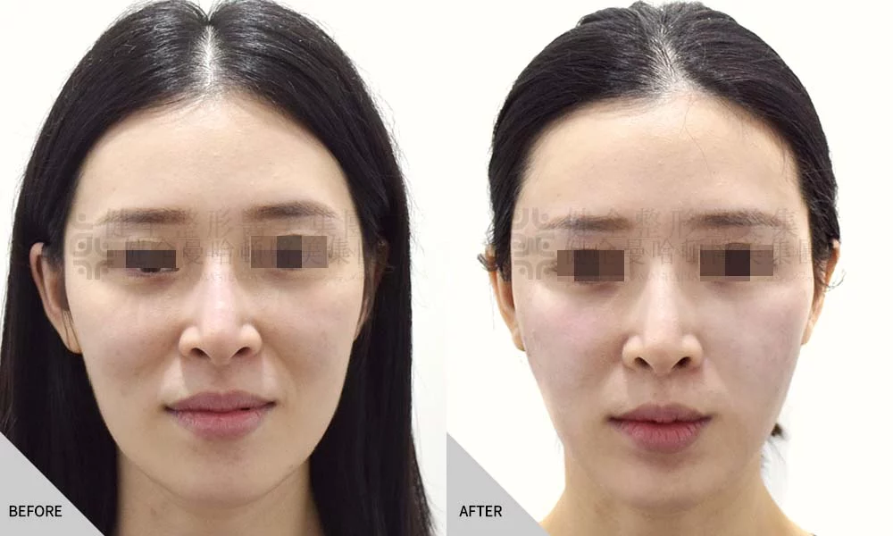 真童妍拉提術 02