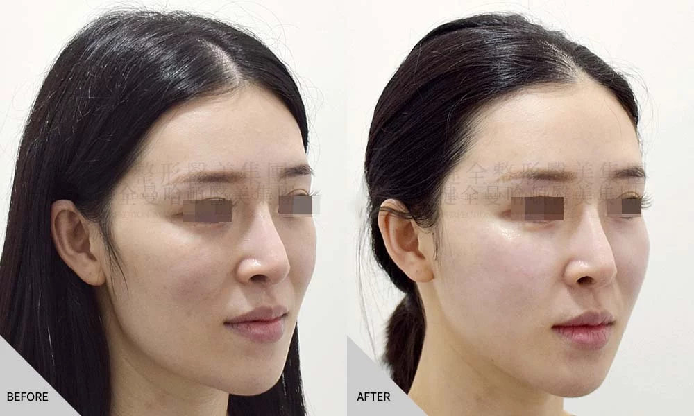 真童妍拉提術 03