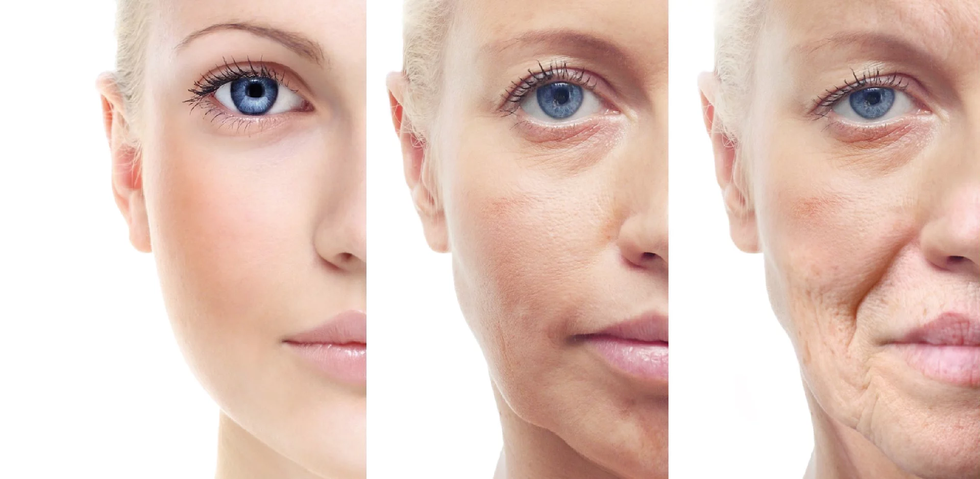 真童妍拉提術 老化圖