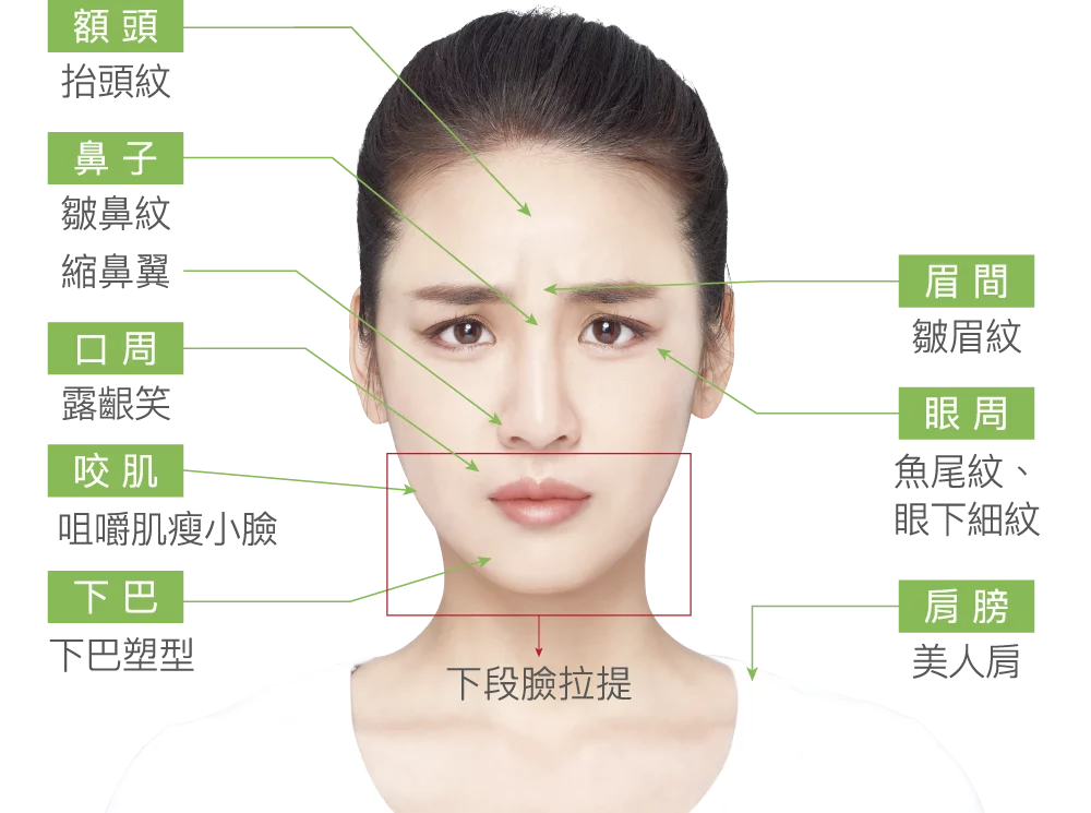 肉毒桿菌 施打部位 01 