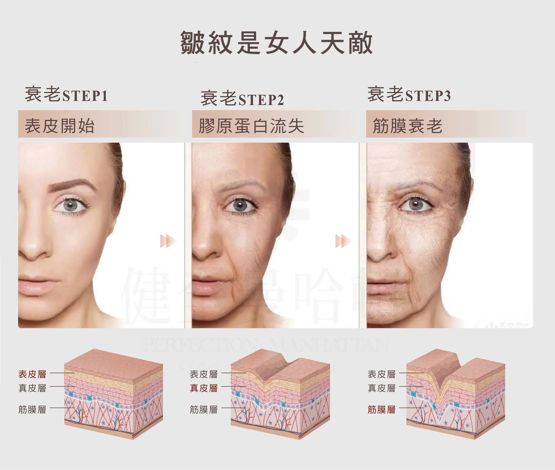 臉部拉皮手術 皺紋 1