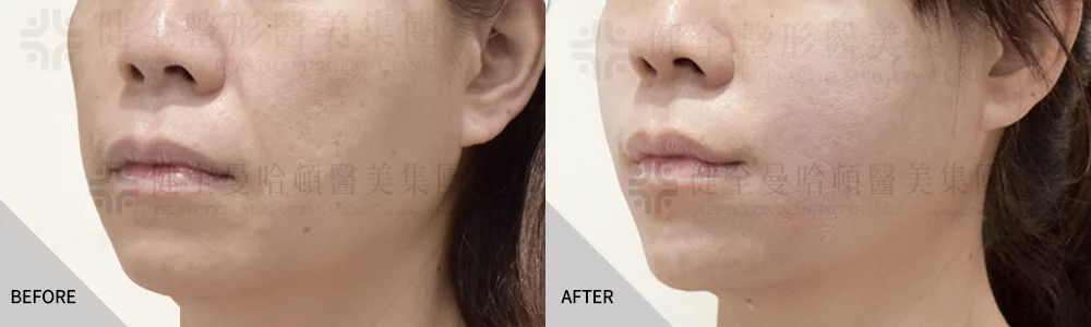 舒顏萃案例 02