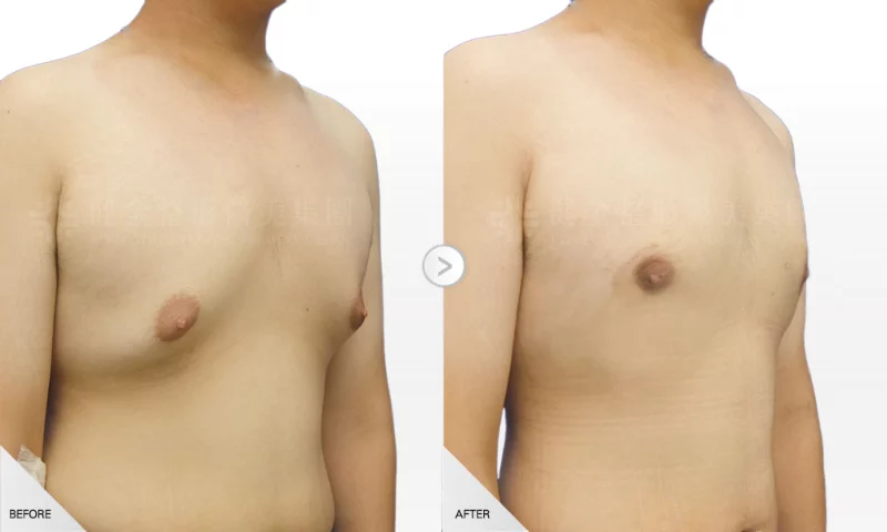 賴人瑞 男性女乳2 一字